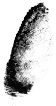 L middle